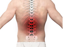 Back Pain