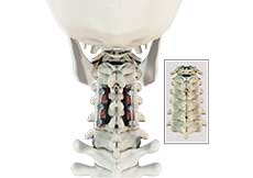 Cervical Spine Fusion