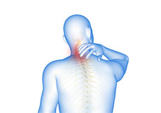 Cervical Spondylosis