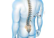 Endoscopic Spine Surgery