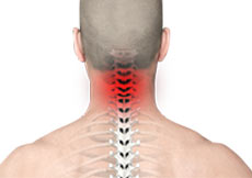 Neck Pain