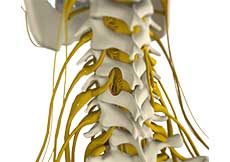 Posterior Cervical Foraminotomy