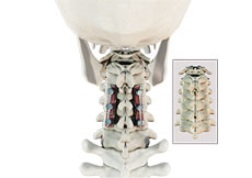 Posterior Cervical Fusion