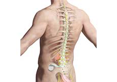 Spinal Cord Stimulator