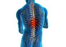 Spinal Infection